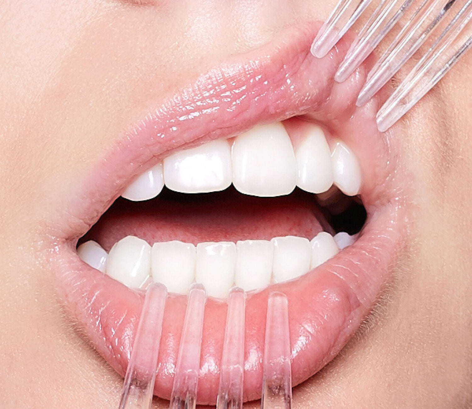 8 worst foods for your teeth